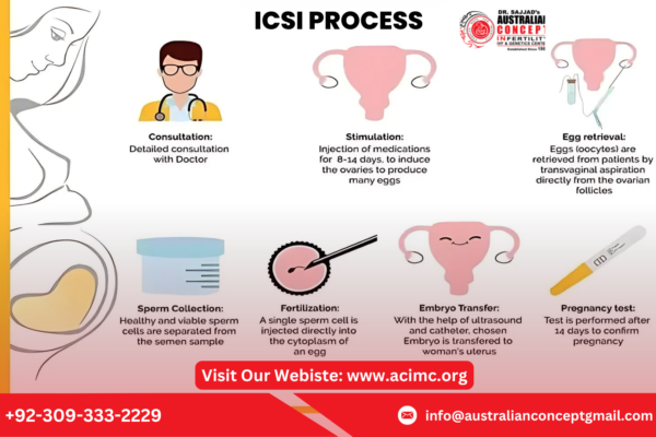 ICSI Treatment