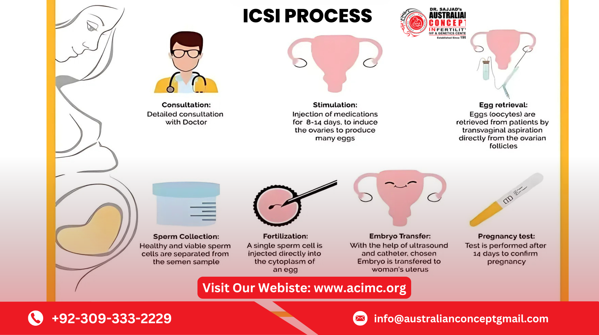 ICSI Treatment