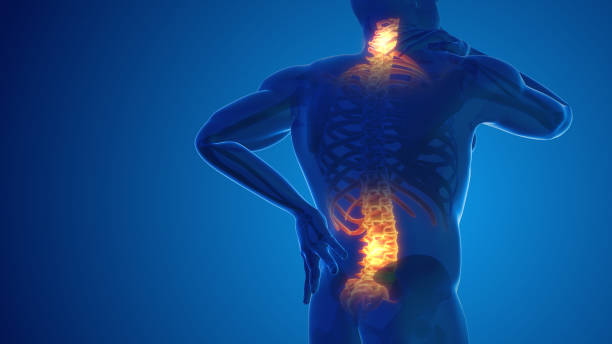 Back Pain Management