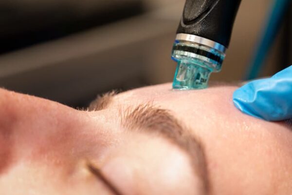 Hydrafacial in Dubai