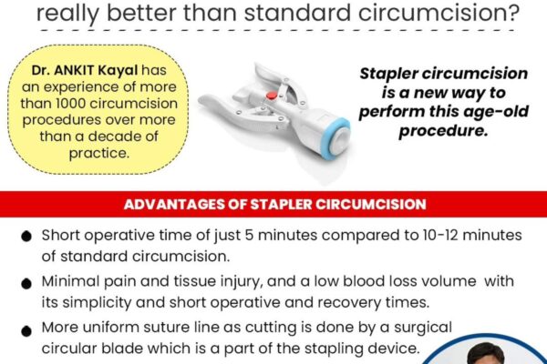 Laser Treatment for Kidney Stones: Is It Right for You? ZSR
