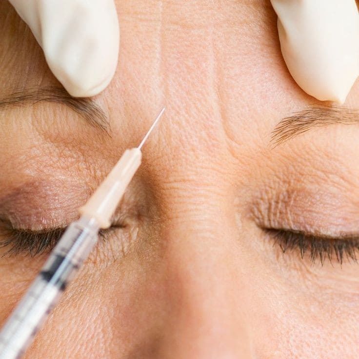 How Does Baby Botox Prevent Premature Aging?