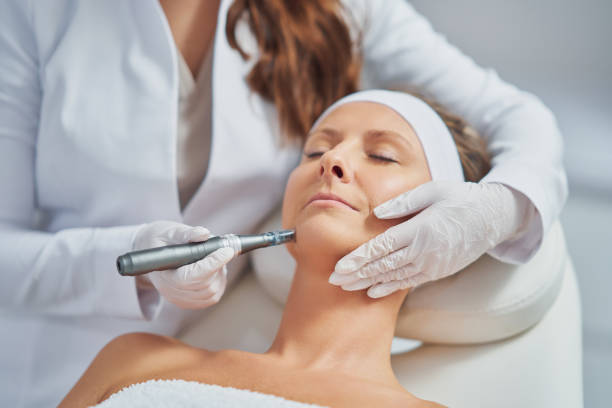 How Long Does Mesotherapy Last