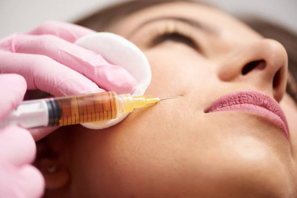 How Often Should You Get Cheek Fillers