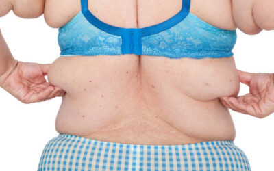 What Are the Types of Bariatric Surgery Available?