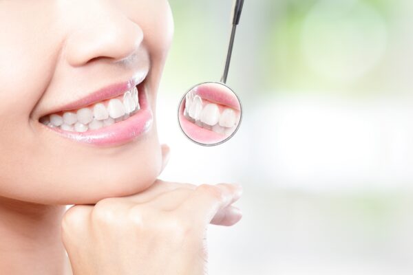 Fix Chipped, Crooked or Gapped Teeth – Here’s How Joondalup Dentists Can Help