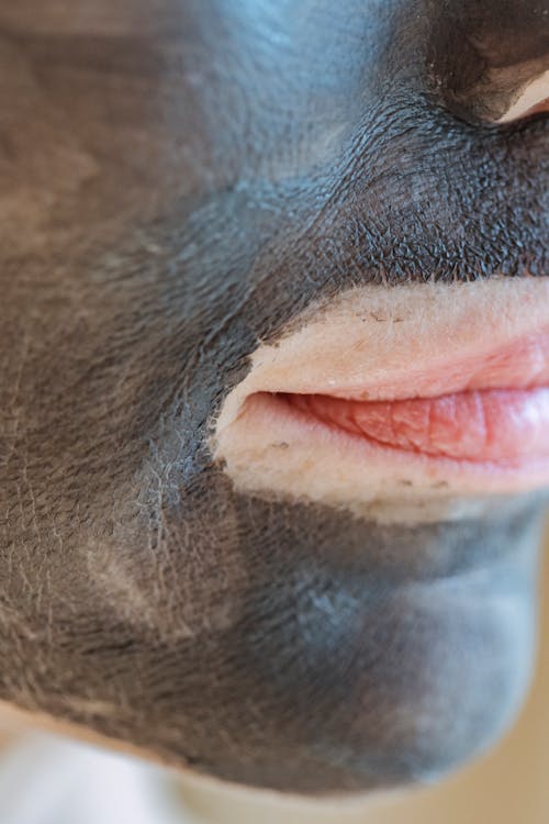 Laser Carbon Peel