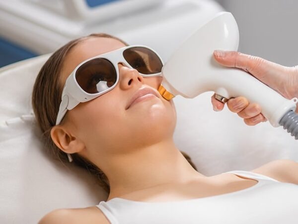 laser scar removal bradenton fl