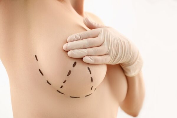Does Breast Lift Surgery Leave Any Scars? Does Breast Lift Surgery Leave Any Scars