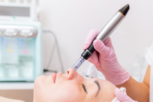 Does Fractional RF Microneedling Reduce Scars