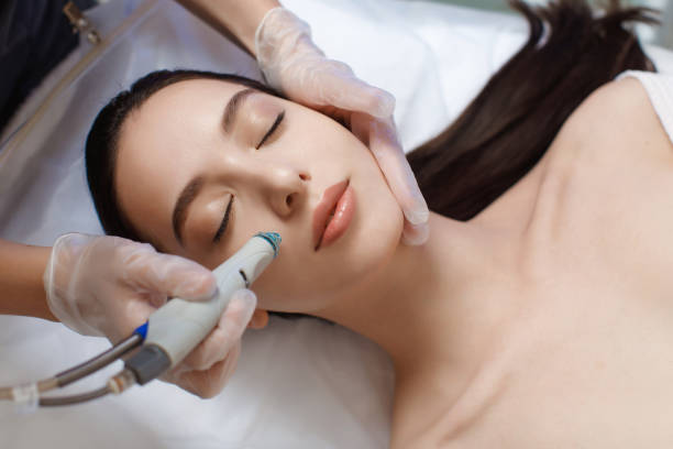 Does HydraFacial Treat Acne