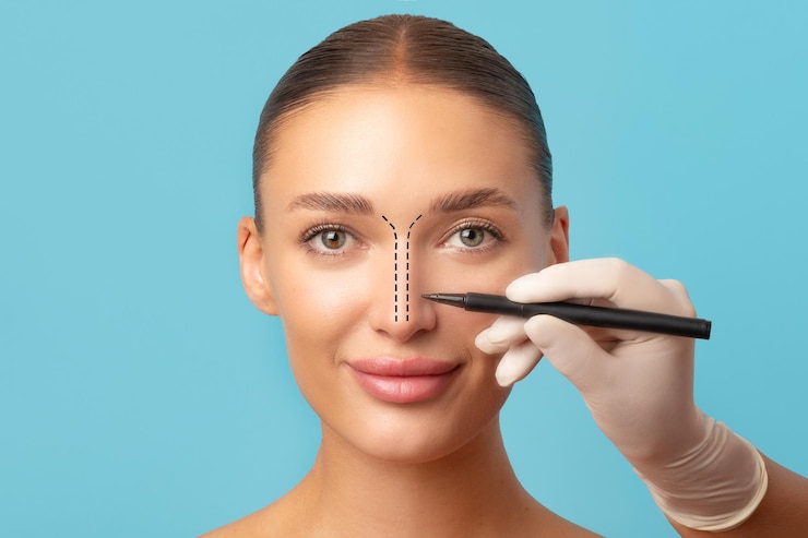 Does Rhinoplasty Surgery Boost Confidence?