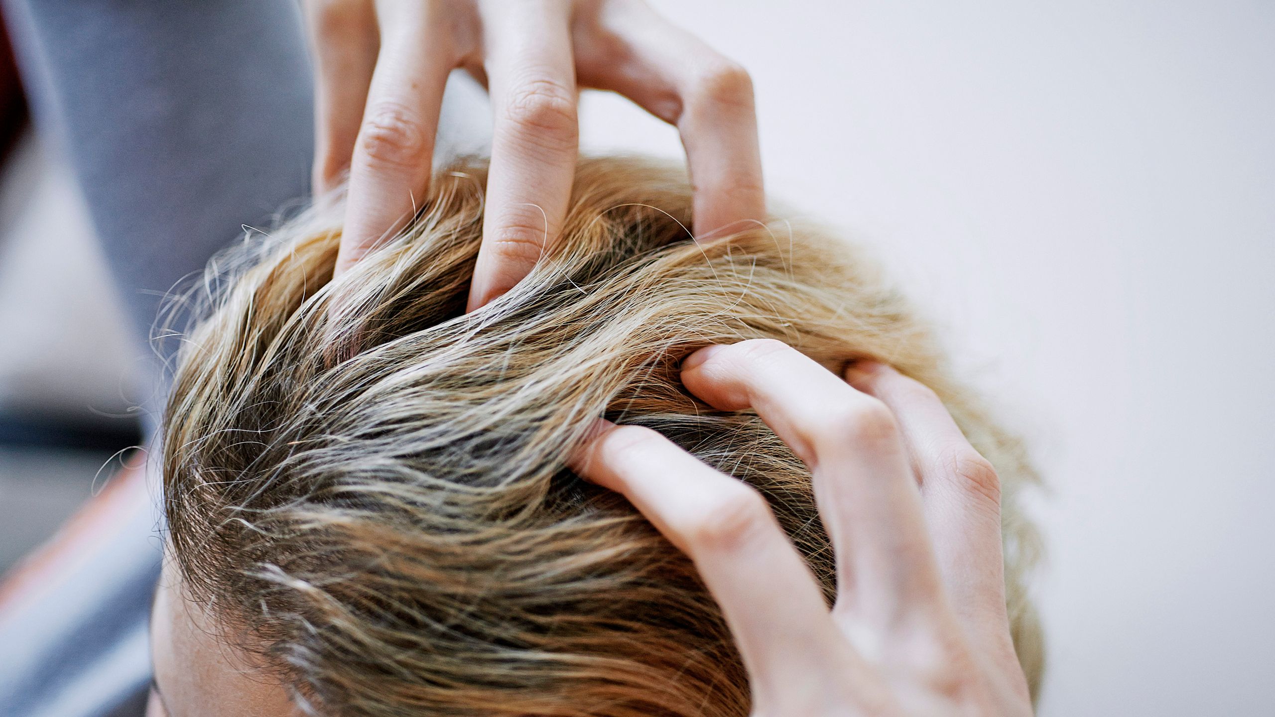 Crown Hair Transplant