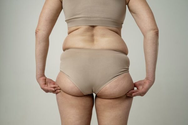 How Does Brazilian Butt Lift Surgery Work?