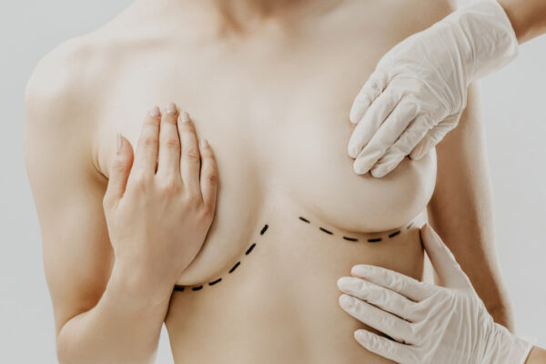 How to Prepare for Breast Surgery