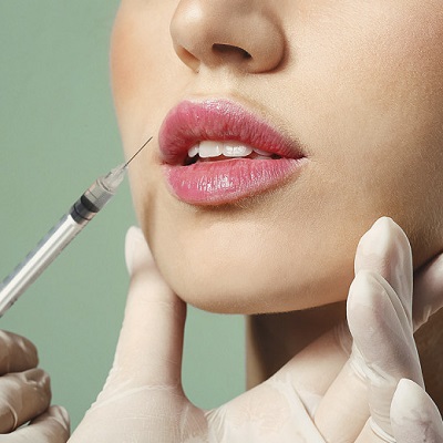 Unlock Gorgeous Lips Discover Top Lip Injections Now