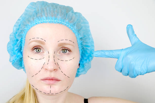 What Are the Benefits of a Facelift