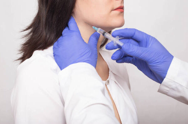 What Makes Kybella So Popular