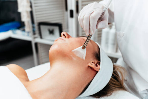 How Do Chemical Peels Work on the Skin?
