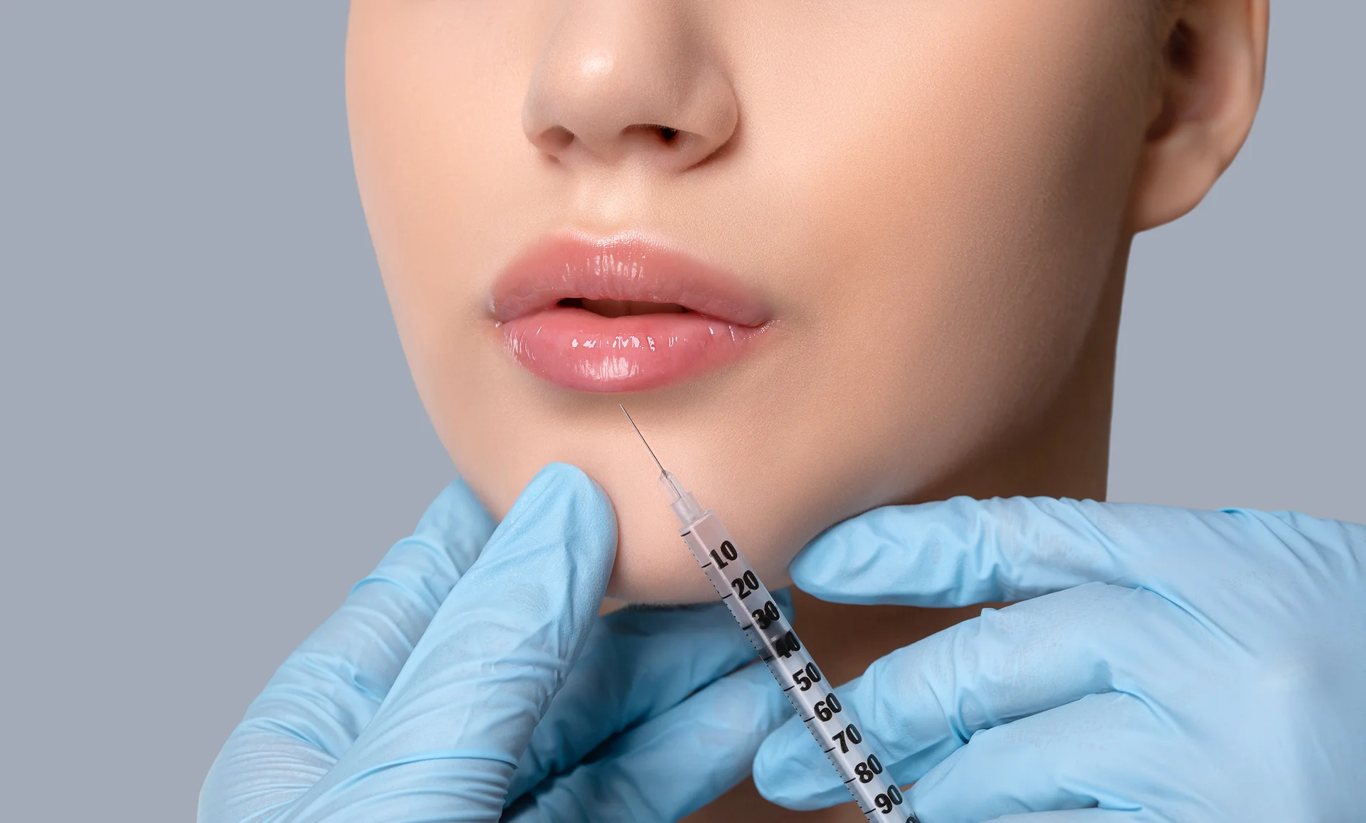 How Soon Can You See Lip Fillers Results?