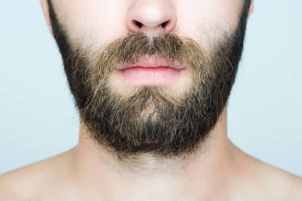 Is Beard Hair Transplant Right for Me
