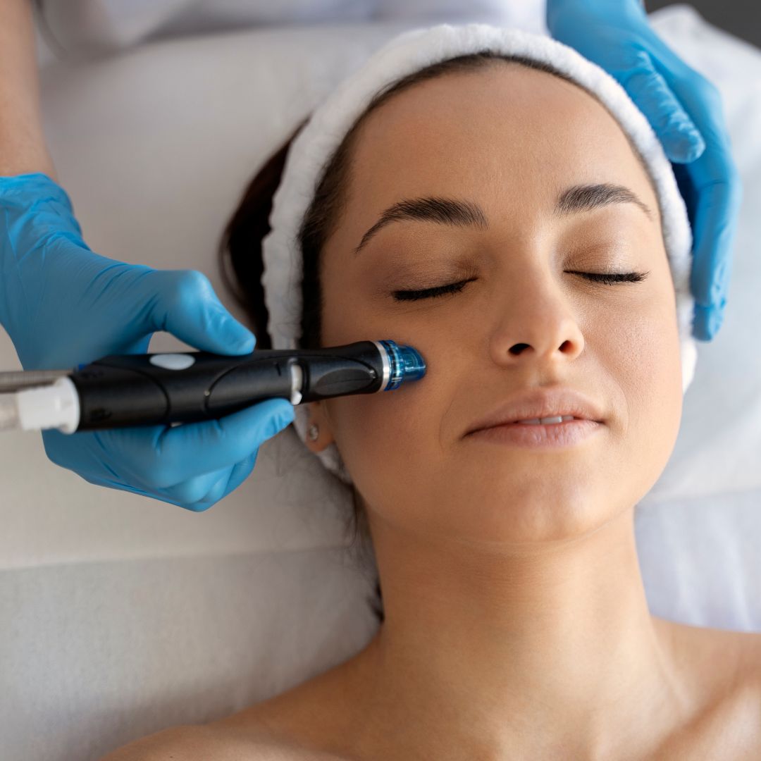 Is HydraFacial Good for Oily or Acne-Prone Skin?