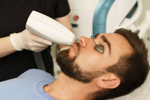 Is Men’s Laser Hair Removal Good for Back Hair