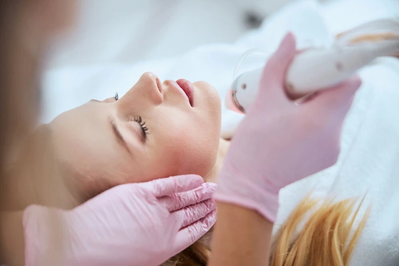 Is Microneedling Safe for Sensitive Skin