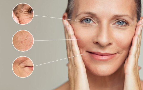 What Can a Dermatologist Do for Wrinkles?