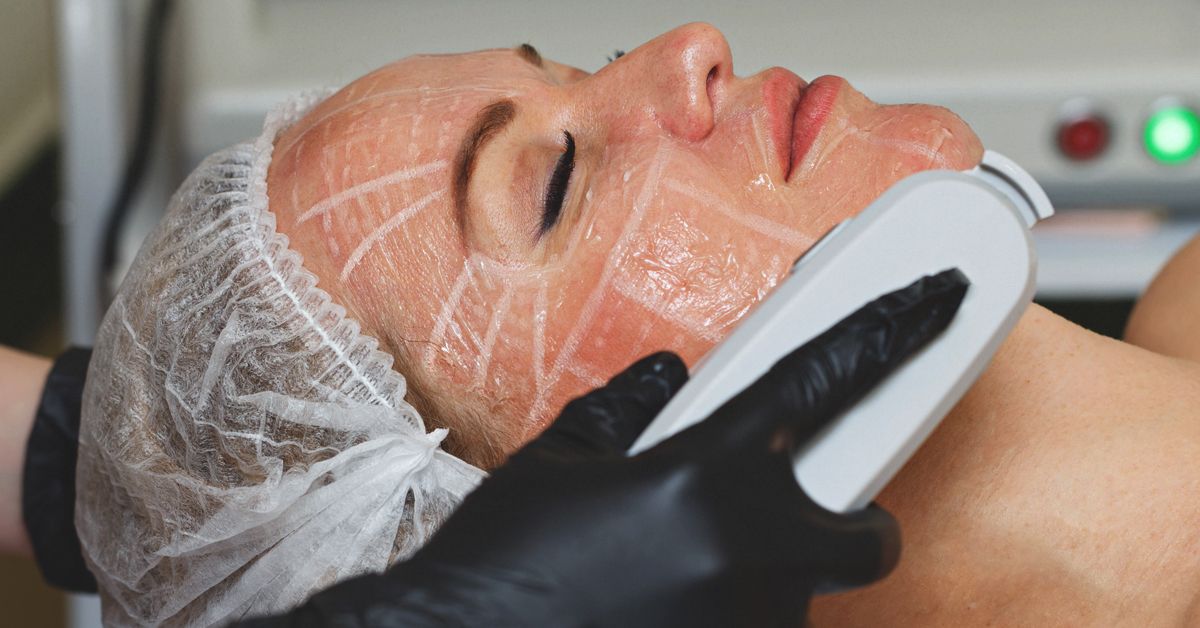 What Is HIFU Treatment and How Does It Work