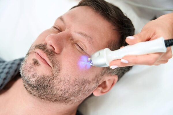 Is Radiofrequency Treatment Safe For All Skin Types?