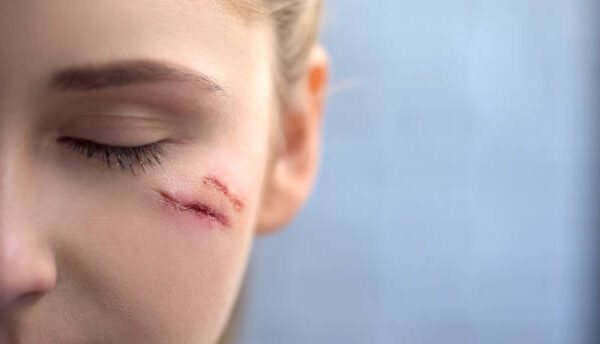 What Scars Can the Best Plastic Surgeon Treat? What Scars Can the Best Plastic Surgeon Treat