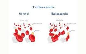 Thalassemia Treatment in India: Success Stories & Patient Experiences