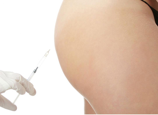 Are Butt Fillers Suitable for Slim Body Types