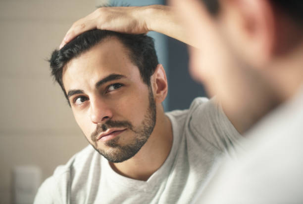 Does Hair Transplant Look Natural