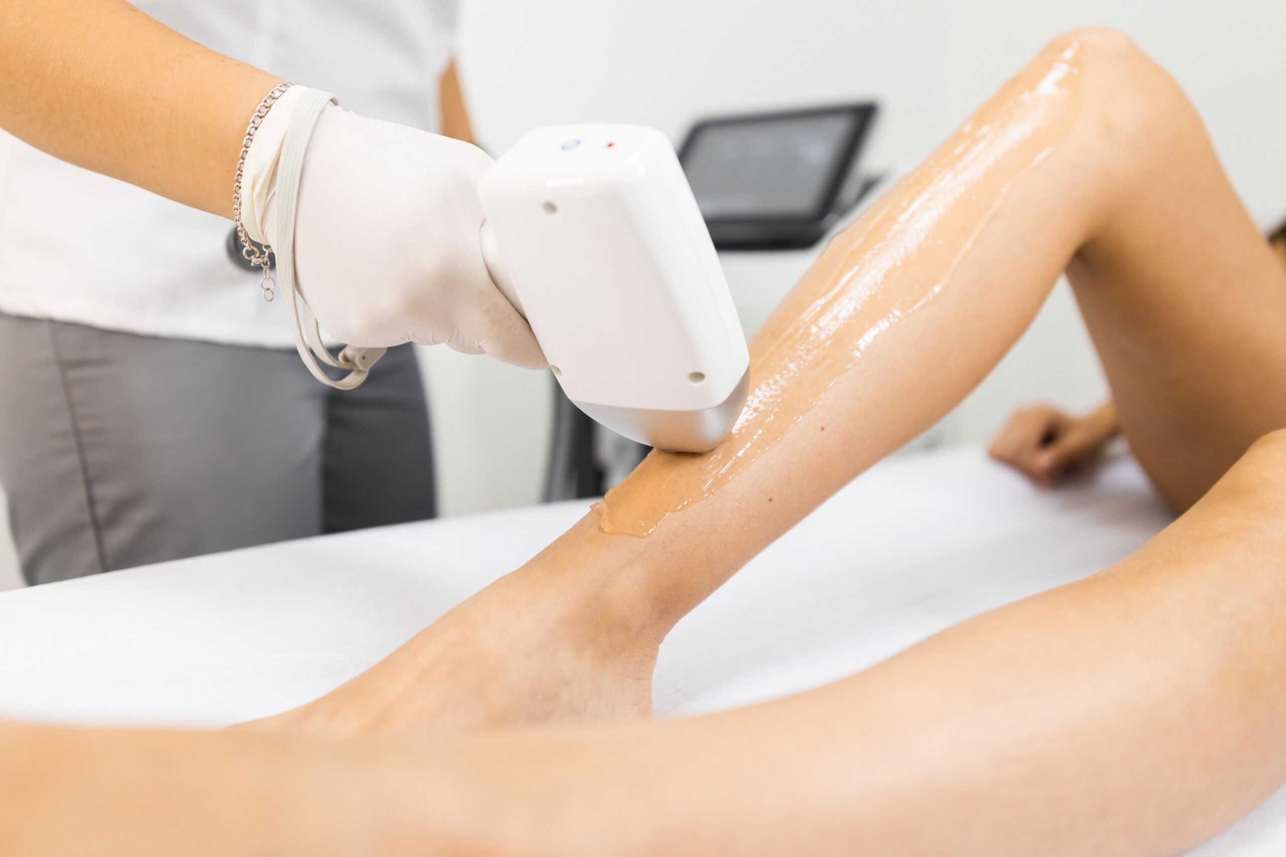 Does Laser Hair Removal Work on Blonde Hair?