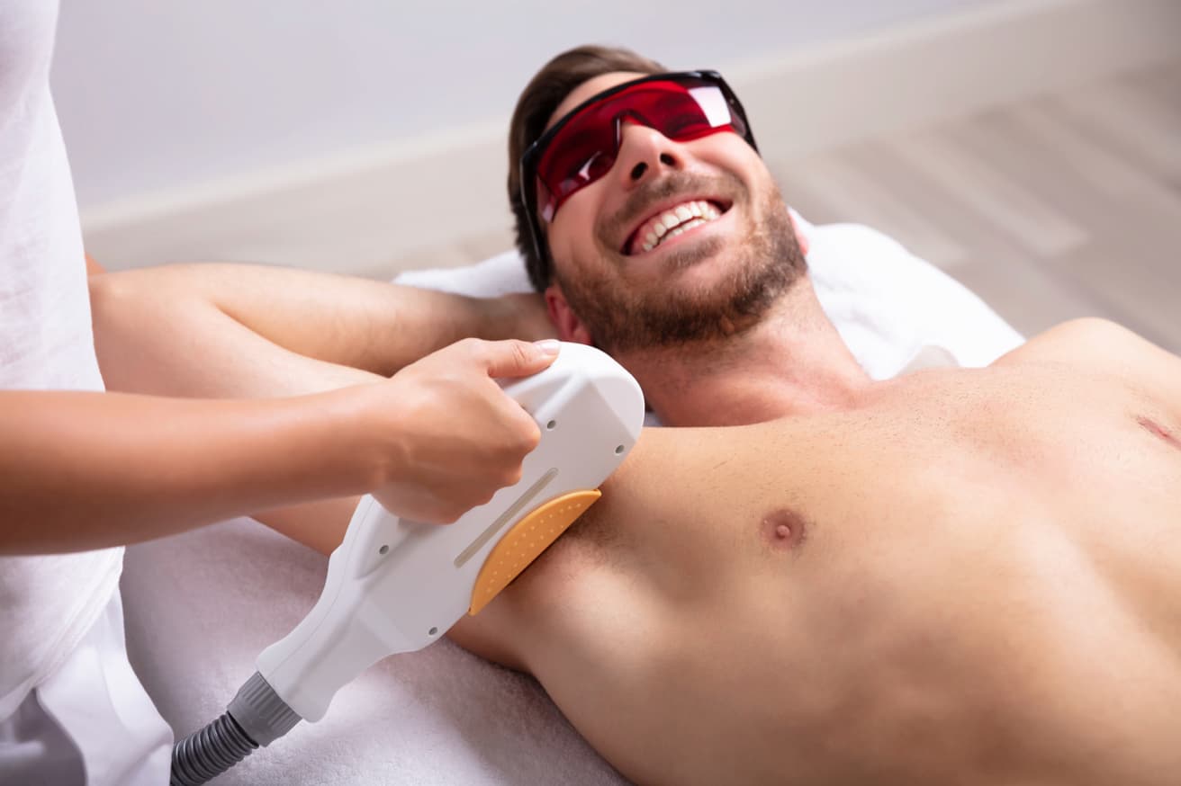 Is Men’s Laser Hair Removal Permanent After All Sessions