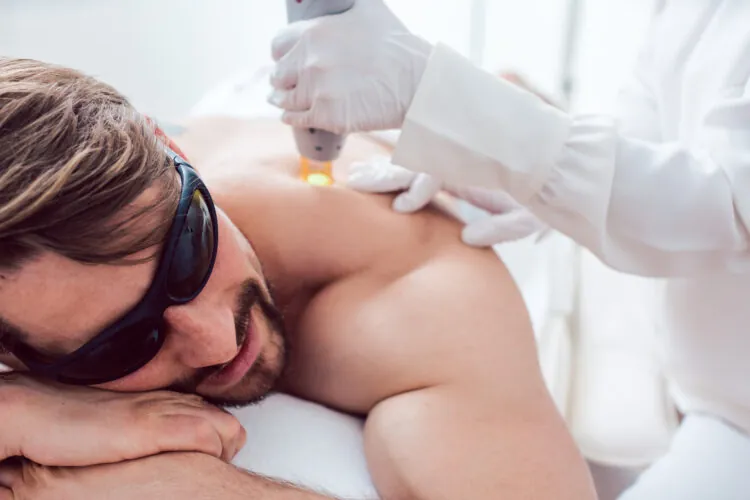 Is Men’s Laser Hair Removal the Best Option for Back Hair