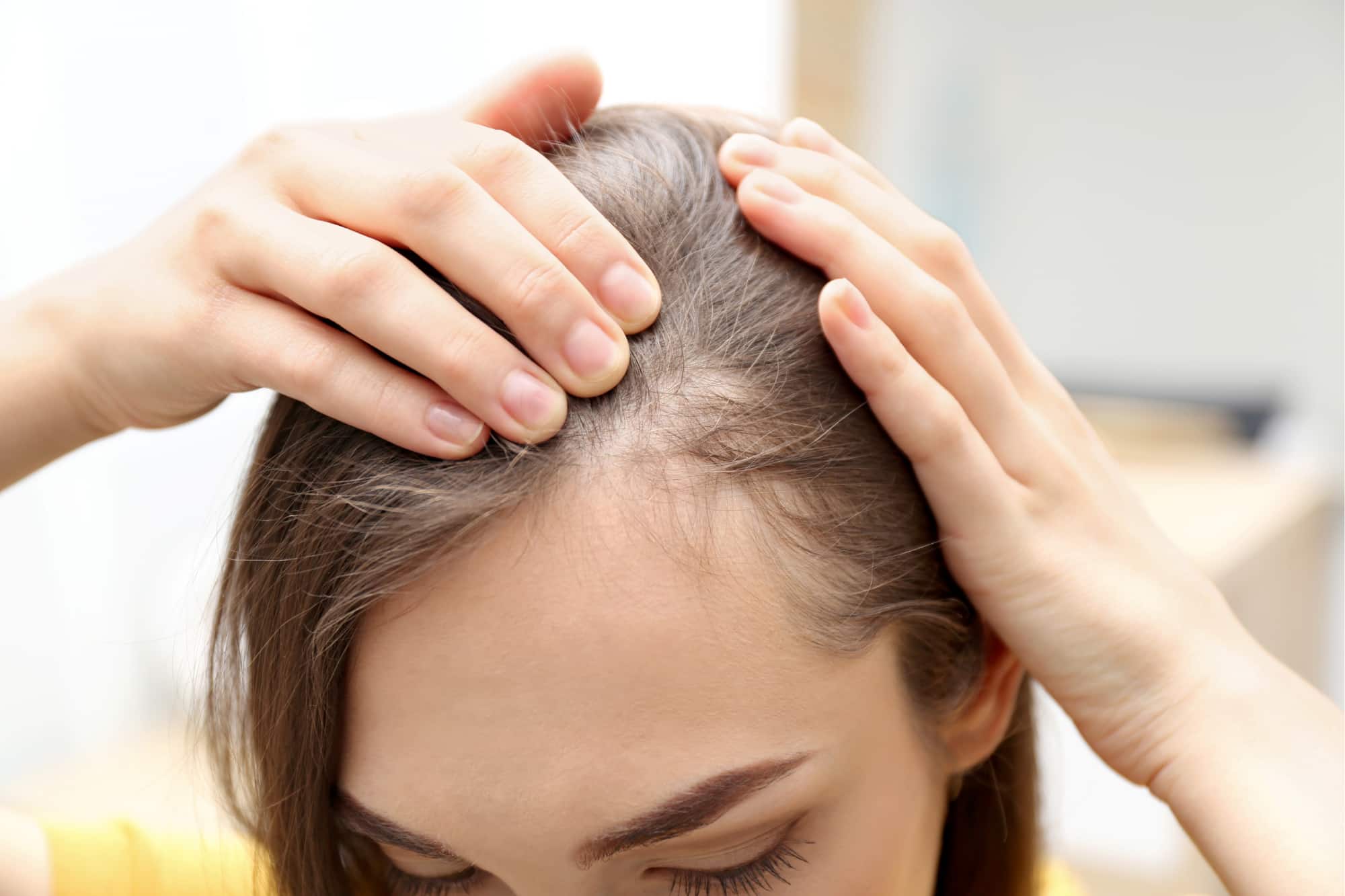 Is PRP Hair Treatment Right for You?