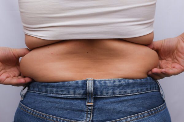 Liposuction Surgery for Body Transformation
