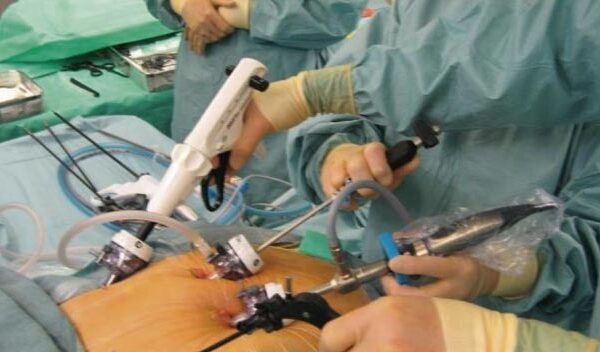 Thinking About Bariatric Surgery? Read This First Thinking About Bariatric Surgery?