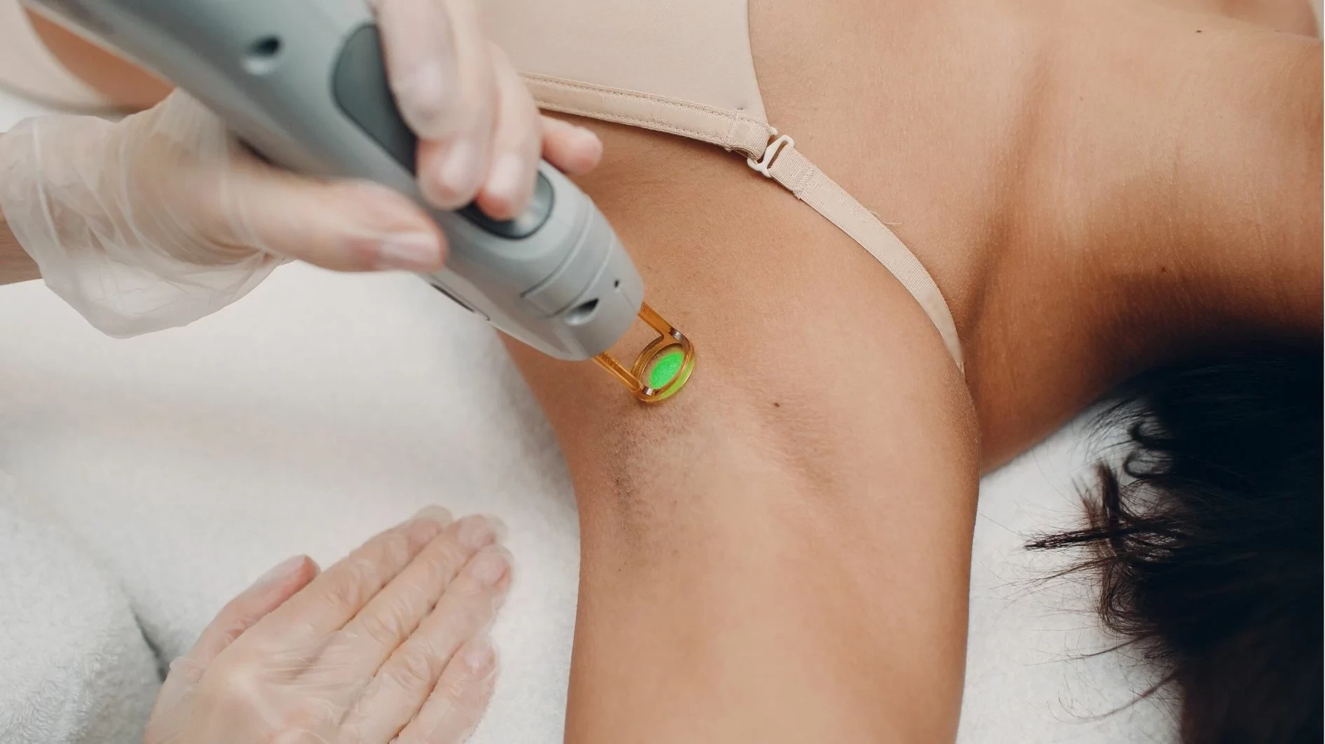 What Is Laser Hair Bleaching And How Does It Work