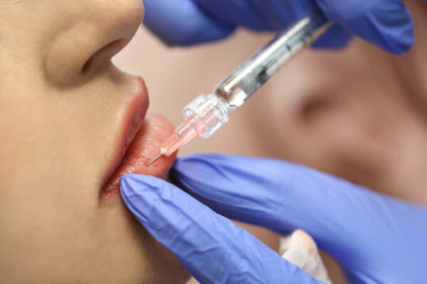What’s the Right Age to Start Lip Fillers Enhancements? What’s the Right Age to Start Lip Fillers Enhancements