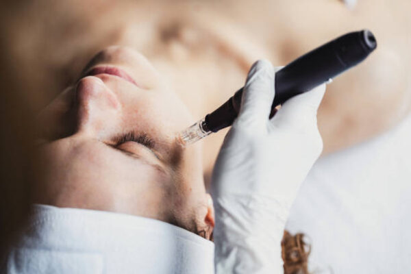 Can Dermapen Microneedling Fix Uneven Skin Texture