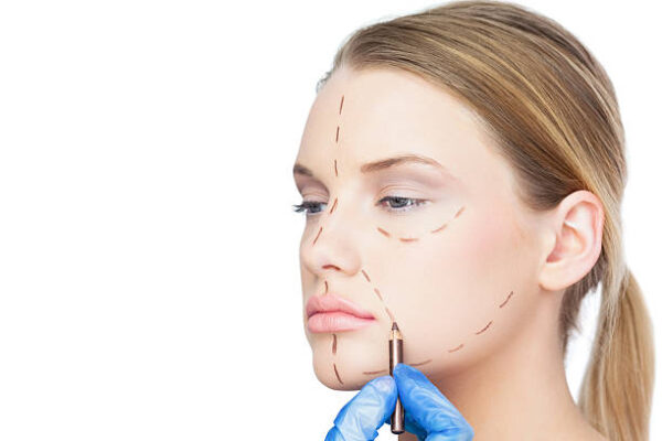 Can Facelift Improve Double Chin Appearance