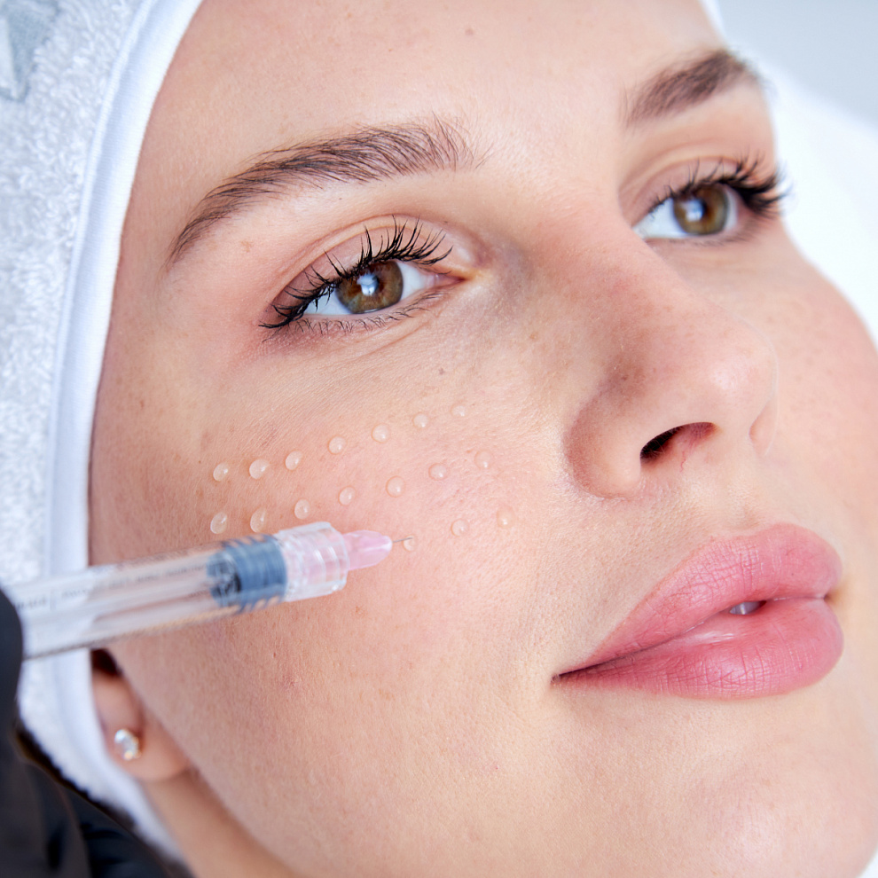 Can Skin Booster Injection Treat Dry, Dull Skin