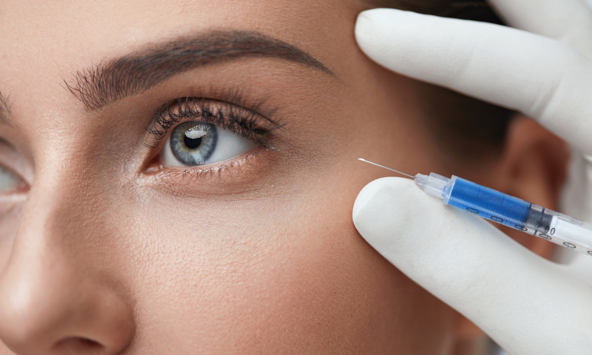Do Under Eye Fillers Look Natural or Fake