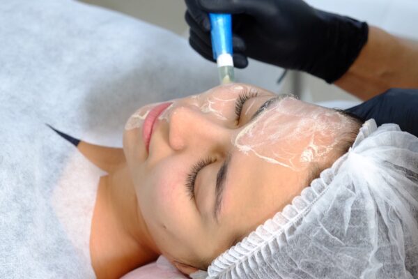 Does BB Glow Treatment Brighten Your Complexion?