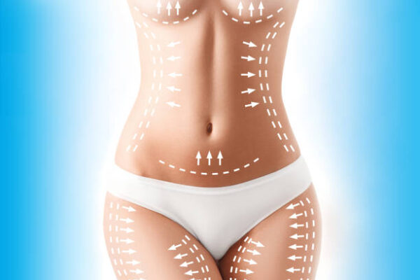 How Liposuction Helps Remove Stubborn Fat Effectively