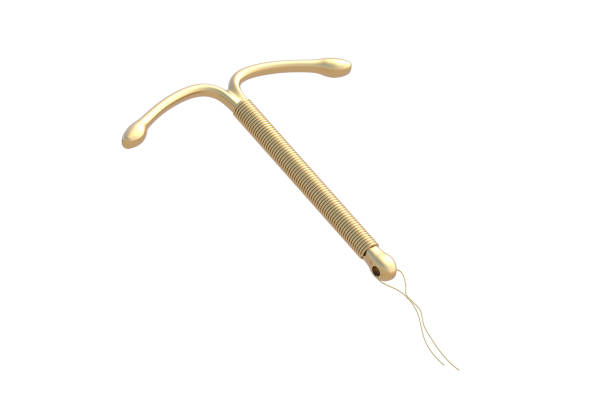 Is Copper T Reversible if You Plan for Pregnancy